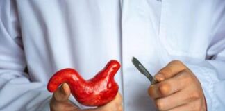 Chirurgia bariatrica tra robotica, IA e Linee guida per la gestione del paziente