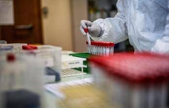 Covid, l’Aspirina frena l’attacco del virus e limita il danno ai polmoni: l’ultimo studio