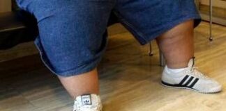 Iss, 40% adulti con problemi di peso, 1 su 10 è obeso