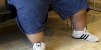 Nutrizionista, ‘senza politiche anti-obesità meno anni di vita per generazioni future’