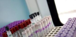 Ricerca, proteina sangue albumina predice rischio cancro e infarto in ‘over 65’