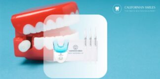 Come sbiancare i denti velocemente?