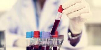 Come vivere più a lungo? Il test del sangue svela la longevità