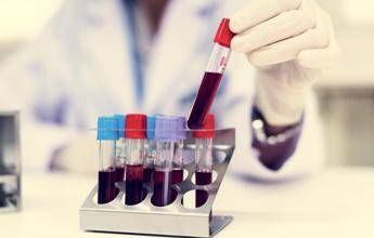 Come vivere più a lungo? Il test del sangue svela la longevità