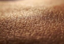 Dermatite atopica, quando la pelle condiziona la vita, ‘Diari atipici’ dà voce ai pazienti