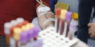 Egpa, l’esperto: “Diagnosi difficile ma con anti Il-5 ottimi risultati”