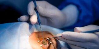 Medicina, 10 infezioni corneali al giorno, trapianto parziale precoce salva l’occhio