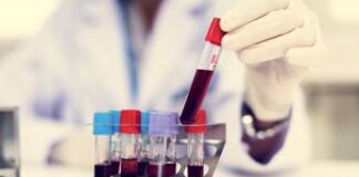 Parkinson, un test del sangue per scoprirlo 7 anni prima dei sintomi: la ricerca