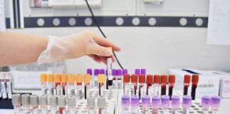 Uap: “Manifesteremo contro esami in farmacia, ministro Schillaci ci convochi”