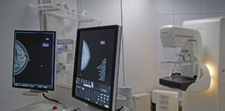 Mammografia Ulss 7 Pedemontana, avviato un sistema di intelligenza artificiale per la refertazione Mammografia Ulss 7