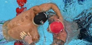 Coppettazione aiuta nel nuoto alle Olimpiadi 2024? I medici: “Non ha basi scientifiche”
