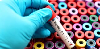 Epatite C, Oms prequalifica il primo test fai-da-te