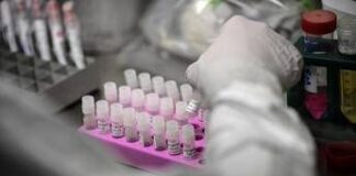 Rischio Long Covid, scoperta variante genetica che lo aumenta del 60%