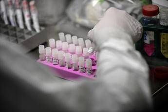 Rischio Long Covid, scoperta variante genetica che lo aumenta del 60%