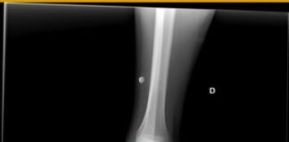 ‘Ai radiologo’ al San Camillo di Roma, diagnosi con l’assistente virtuale