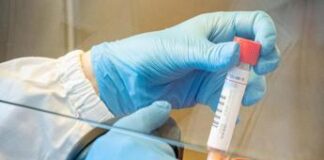 Covid Italia: nuovi casi in lieve calo, salgono i decessi