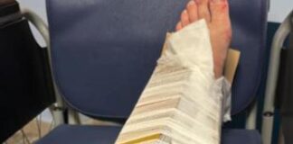 Frattura steccata con il cartone, rimossa responsabile Pronto Soccorso