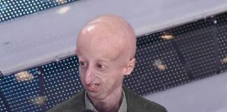 Vaiolo delle scimmie, su X fake news per infangare comunità LGBTQ+ con foto Sammy Basso affetto da progeria: è bufera social Vaiolo delle scimmie, su X fake news con la foto di Sammy Basso: è bufera social