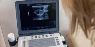 Cardiomiopatie, studio conferma efficacia inibitore miosina cardiaca