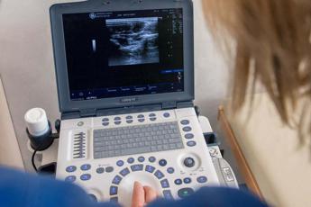 Cardiomiopatie, studio conferma efficacia inibitore miosina cardiaca