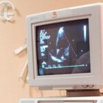 Giornata del cuore, cardiologi lanciano primo Piano strategico nazionale