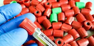 Studio, aggiunta di acido bempedoico riduce in modo efficace colesterolo Ldl