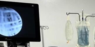 Tumore del seno triplo negativo, immunoterapia prima e dopo chirurgia aumenta sopravvivenza