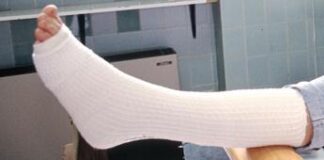 Al via Trauma Meeting, esperti a confronto su fratture e complicanze