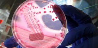 Escherichia coli, allarme dopo hamburger McDonald’s: 49 casi e 1 morto