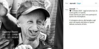 Morto Sammy Basso, il 28enne malato di Progeria