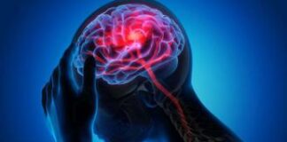 Padovani (Sin): “In Italia 32 mln con disturbi neurologici ma diagnosi è spesso tardiva”