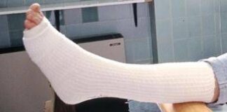 Toccare una frattura nella realtà aumentata, da UniPi sensore tattile low cost