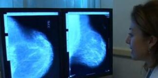 Cancro al seno, un nanofarmaco potrebbe bloccare le metastasi: lo studio