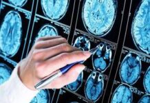 Alzheimer, 300mila euro a 6 scienziati per diagnosi precoce e prevenzione