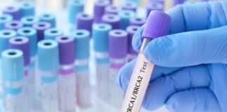 Cancro seno con mutazione Brca, 88% pazienti trattati con Olaparib è vivo a 6 anni