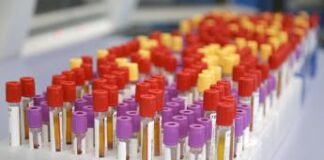 Caos decreto tariffe, Uap: “Acceso faro verità su errori, ci auguriamo arrivino correzioni”