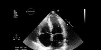 Ecografia polmonare, Italia all’avanguardia con buone pratiche cliniche