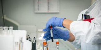 Malattia Congo, Oms: “891 casi mix virus, malaria e malnutrizione”