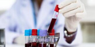 Malattia misteriosa Congo, ipotesi malaria: quali sono i sintomi