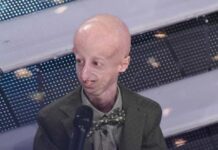 Mattarella, il discorso e l’omaggio a Sammy Basso