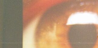 Rilancio Holostem, terapia salva-cornea a 1 paziente e già altri in lista