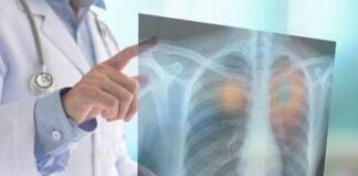 Cancro seno per 1 donna su 8, nuova frontiera in chirurgia conservativa