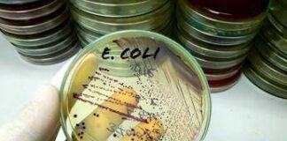 Da salmonella a listeria a E.Coli, ipotesi in campo in tossinfezioni alimentari