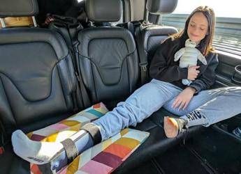 Francesca Michielin con il tutore prima di Sanremo: “Caduta anche stavolta”
