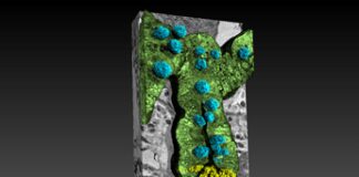 Rivelato il legame intestino-cervello nell’Alzheimer grazie ai raggi X