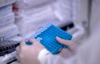 Scoperto il virus gigante Ushikuvirus, lo studio: “Può darci indizi su origine della vita”