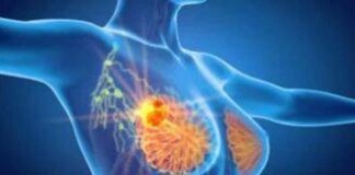 Tumore al seno, in Piemonte biopsia liquida utile a 500 pazienti l’anno