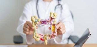 Cancro al colon, microbioma può predirne rischio e guidare diagnosi precoce