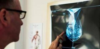 Cancro al seno, crioablazione nuova frontiera di cura