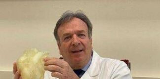 Medicina: prima mondiale a Padova, esiti infezione aspirati da aorta a cuore battente